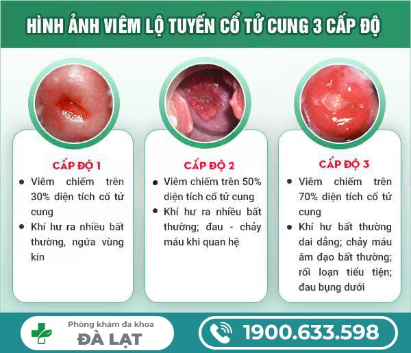 Hình ảnh minh họa